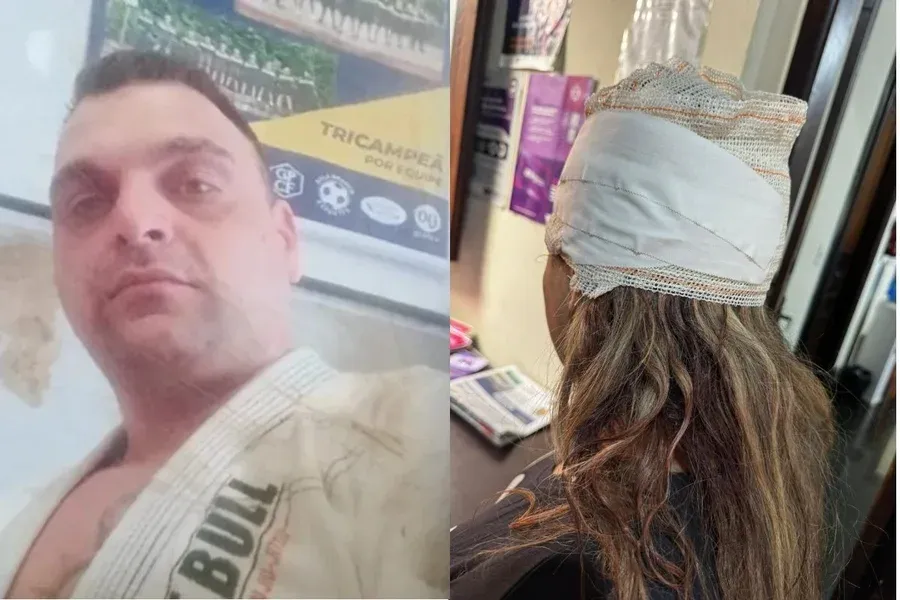 Lutador de jiu-jítsu espanca esposa após se irritar ao ser acordado